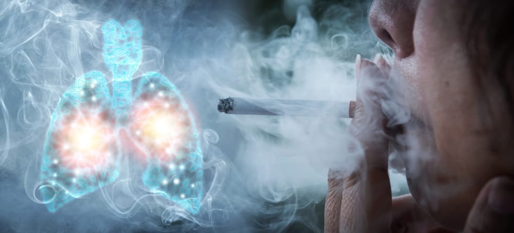 The Deadly Consequences of Smoking: Understanding the Link to Lung Diseases