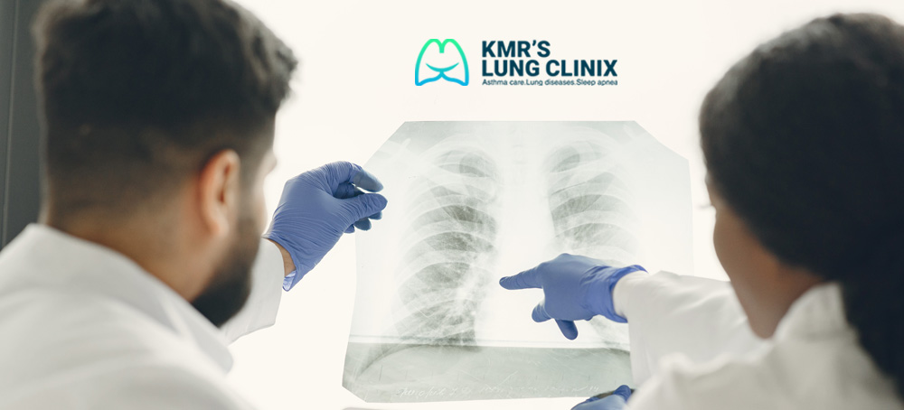 Lung Failure Specialist in Chennai – Complete Guide to Symptoms, Causes & Treatment